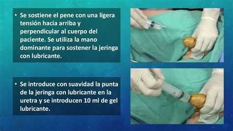 Procedimiento de sondaje vesical. Mujeres